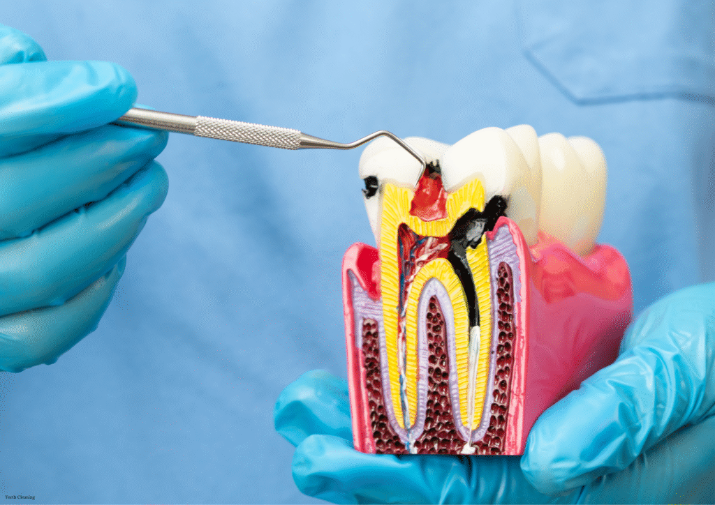Root Canal Treatment In Kalyan